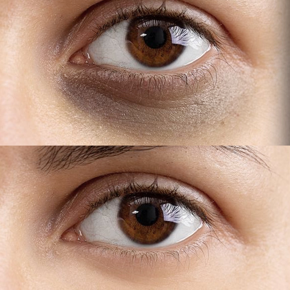 Say goodbye to "panda eyes": a complete guide to easily relieve dark circles