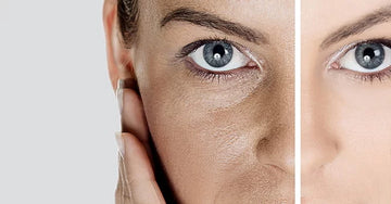 Say goodbye to "yellow-faced women": easily relieve dull skin and regain translucent skin