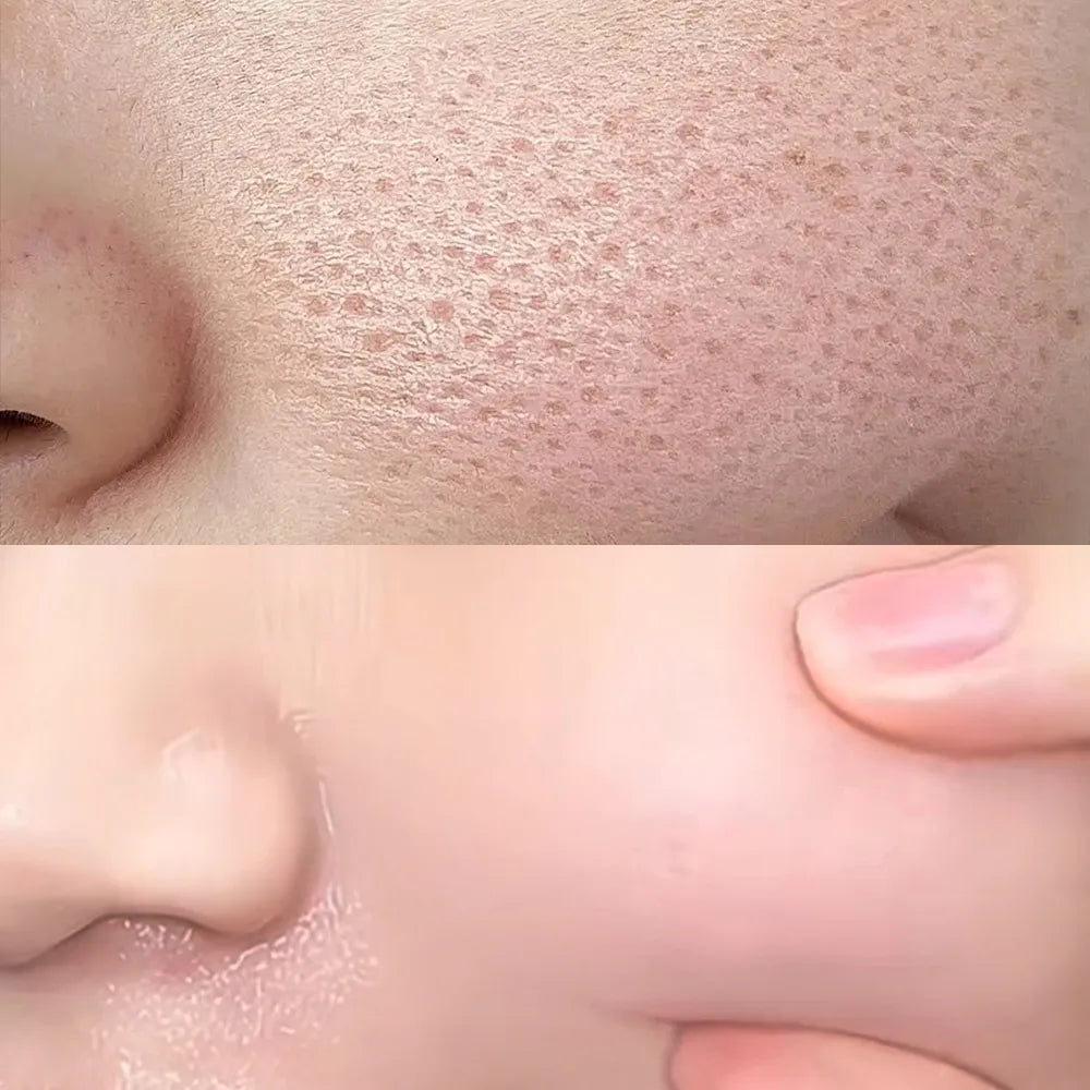 Say goodbye to rough "pore" panic: a practical guide to relieving enlarged pores