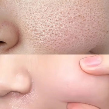 Say goodbye to rough "pore" panic: a practical guide to relieving enlarged pores