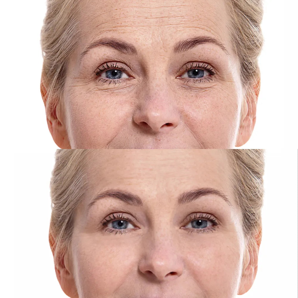Fight the signs of aging: A practical guide to anti-wrinkle and younger-looking skin