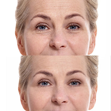 Fight the signs of aging: A practical guide to anti-wrinkle and younger-looking skin