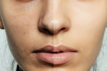 Fight the "pigmentation" problem: practical tips for alleviating pigmentation